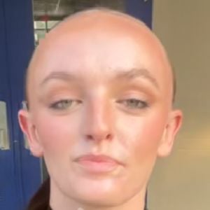 the bald woman