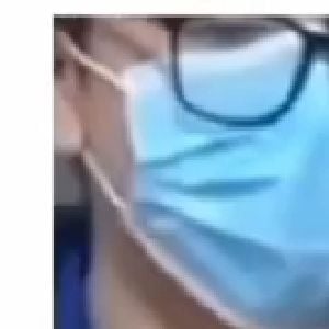 beak face (Joshua)