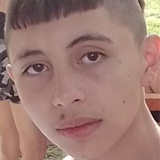 Gay Bald Man