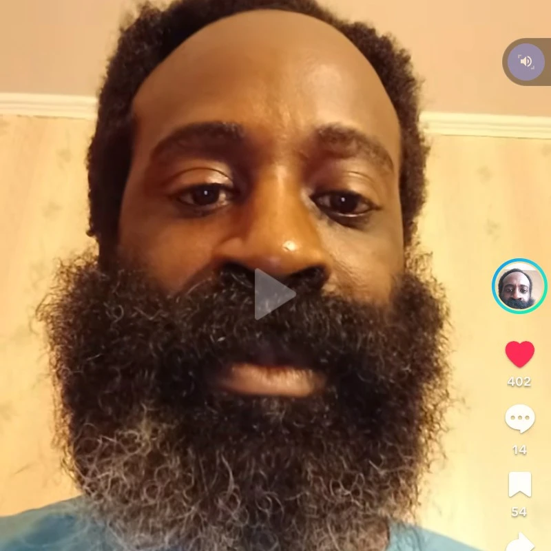 LeBron James hairline